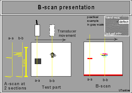 B-scan 